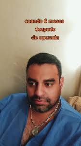 Reflexiones de un cirujano: 6 meses tras la operación