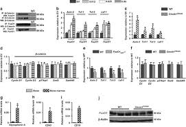 Mar 24, 2021 · buka browser di pc kalian dan kunjungi situs web.whatsapp.com, maka akan muncul kode qr tersebut. Foxo1 Dependent Induction Of Acute Myeloid Leukemia By Osteoblasts In Mice Leukemia