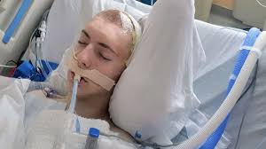 One in a million chance': Sinus infection leads to brain surgery for Idaho  teenage boy