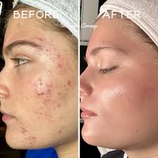 Wittney Fratt Snyder