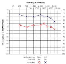 audiometry screening and interpretation american family