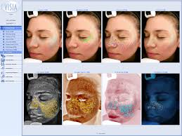 Skin Analyzer Device Skin Observed System Skin Analysis