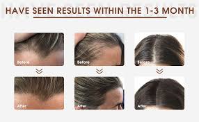 According to a 2017 review in the journal skin appendage disorders, there is little conclusive evidence that biotin reduces hair loss, but it remains a popular supplement for hair, skin, and nail. Amazon Com Biotin Hair Growth Serum With Shampoo For Men And Women Hair Loss Treatment Scalp Hair Regrowth Natural Thickening Volumizing For Thicker Fuller Hair Beauty