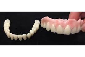 Diy emergency denture repair kit by 1stopdental on etsy 3. Dental Impression Plus Diy Denture Kit Bridge Denture Teeth Etsy Dental Impressions Partial Dentures Denture