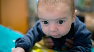 'where can i have / get my hair cut?' Plagiocephaly Or Flat Head In Babies Raising Children Network