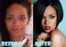 Blac Chyna Before Fame Chirurgie Der Etwas Hat Mit Nie Plastischen Rihanna Vielleicht Wirklich Z Prominente Plastische Chirurgie Plastische Chirurgie Kosmetische Chirurgie
