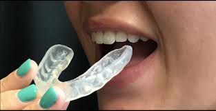 Check spelling or type a new query. Should You Wear A Sports Guard Mouthguard Wildewood Dentistry