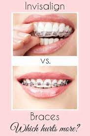 Does Invisalign Hurt Invisalign Braces Tips Invisalign Vs Braces