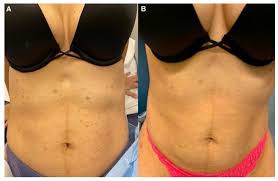 Image result for Pleiotaxis