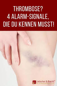 Eine thrombose kann aber auch gänzlich ohne symptome auftreten und sich weiter ausdehnen. Thrombose Verdacht Diese 4 Anzeichen Verraten Es Schmerz Gelenkschmerzen Beinschmerzen