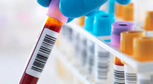 If the test is positive, it is with 99.9% confidence. Test Your Knowledge Of What Blood Tests Can Tell You