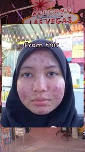 Paling LARIS, Paling DIMINATI. Pori besar? U standby ok. Mylara tak bagi  chance kau u tau! 😜 [ 𝗠𝗬𝗟𝗔𝗥𝗔 𝗚𝗟𝗢𝗪𝗜𝗡𝗚 𝗖𝗟𝗘𝗔𝗡𝗦𝗘𝗥 ]  Pembersih wajah dalam bentuk gel, berbau haruman floral segar, bewarna