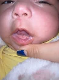 Baby born with all her teeth 🦷 intact