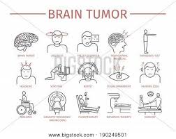 This type of blood cancer is due to a rapid overwhelming production of white blood cells that are abnormal. Brain Tumor Cancer Vector Photo Free Trial Bigstock
