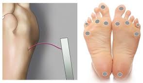 Diabetic Foot Care Figure 1 Monofilament Bent To Form A C Shape Recommended Sites For Feet Care Diabetic Feet Wound Care