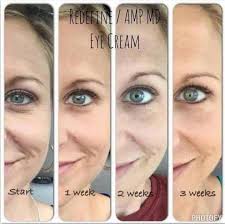 More Proof Of What Rodan And Fields Redefine Eye Cream Combined With The Amp Roller Will D Rodan Fields Skin Care Rodan And Fields Redefine My Rodan And Fields