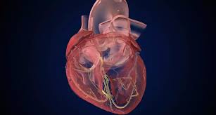 Image result for Myocardial Infarction Stabilization