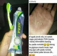 Pasta Gigi Khusus Karang Gigi Testimoni Pengguna Dan Pemakai Pasta Gigi Nasa Asli