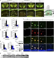 But i thought the online form was a great idea, the chance to save paper. Epps Rescues Hippocampus Dependent Cognitive Deficits In App Ps1 Mice By Disaggregation Of Amyloid B Oligomers And Plaques Nature Communications