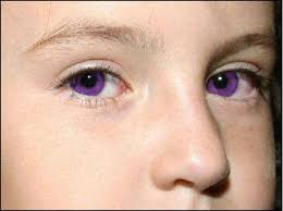 We did not find results for: Pin By G Scotdeerie On Ghost Towns Haunted Places Strange And Just Creepy Things Rare Eyes Rare Eye Colors Eye Color Facts