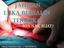 Luka jahitan bersalin normal bernanah. Ubat Luka Jahit Bersalin Berubat V