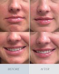 Rhiannon Newsom, NP-C