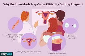 The best way to find your version of this diet is to start with an elimination diet, slowly add things back in, and. How To Get Pregnant When You Have Endometriosis