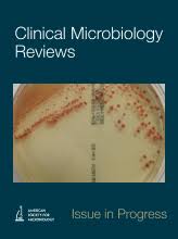 But when a financial officer goes crazy due to drugs, mr. Clinical Microbiology Reviews Journal Homepage