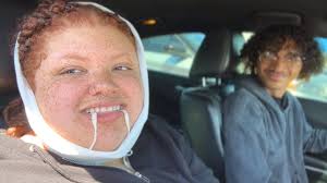 i got my WISDOM TEETH removed and this happened...