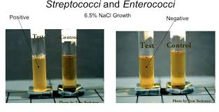 Nacl is also widely used for preventing freezing in snow weather. Salt Tolerance Test For Enterococcus Species Principle Procedure And Results Learn Microbiology Online