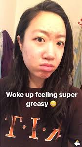 Thoa dầu dừa lên da trong 1 tuần để chữa sẹo mụn, cô nàng này đã nhận được  kết quả đáng thất vọng