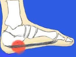 Pin On Heel Pain Helpers