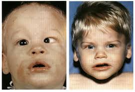 Catatan prestasi Guru Biologi: POLA-POLA HEREDITAS