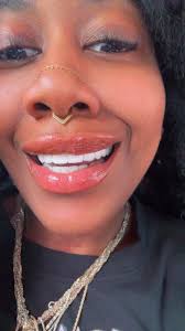 Reviews for Dr. Torres dental work?