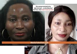 Black And White Bleaching Cream Results Pin On Skin Bleaching
