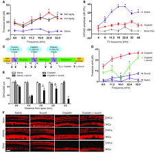 Tell your doctor if you notice any changes in your hearing. Jci Sound Preconditioning Therapy Inhibits Ototoxic Hearing Loss In Mice