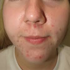 Transforming skin with advanced laser and skincare treatments: Carly  Reznik's success story