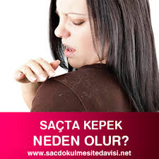 Sacta Kepek Neden Olur