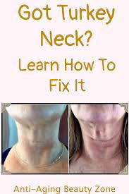We show you the exercises, home remedies, creams and procedures that will get rid of that hated turkey neck for good. Get Rid Of Turkey Neck Neck Tightening Exercises See Results Sagging Neck Skin Tighten Neck Skin Neck Exercises