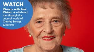 Charles Bonnet's Instagram, Twitter & Facebook