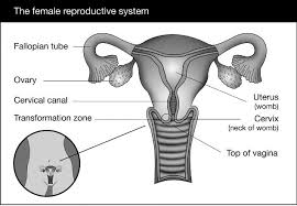 Early on, typically no symptoms are seen. Cervical Cancer