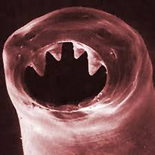 Image result for Hookworm