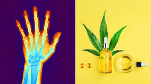 We did not find results for: Should You Take Cbd For Arthritis Pain A New Guide Aims To Help You Decide Everyday Health