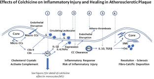 Colchicine can be an effective treatment for gout attacks. Why Colchicine Should Be Considered For Secondary Prevention Of Atherosclerosis An Overview Clinical Therapeutics