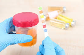 Maybe you would like to learn more about one of these? Waspadai Protein Urine Berlebih Pada Anak Dan Ibu Hamil Alodokter