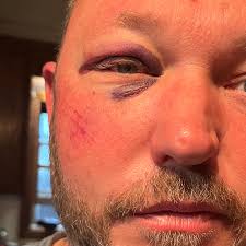 Fundraiser for Ashley Brown by Rita Brooks Brinegar : Ricky's Surgery: A  Path to Recovery