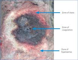 Sulfamylon liquid (5% soln) for wetting heavily contaminated meshed skin grafts or excised but not. Initial Management Of The Burn Wound Patient The Veterinary Nurse