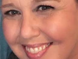 Fundraiser for Casey Plumlee by Haven AndCharley Paul : Surgery for Casey