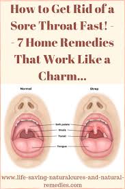 Best Natural Remedies Home Treatments For Sore Throat Strep Throat Treatment For Sore Throat Sore Throat Strep Throat