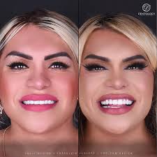 Meet Fernanda! She is part of our Welcome committee in Dentology! A  bilingual CSR, that can help you provide information about any treatment  that you may be interested in and schedule your